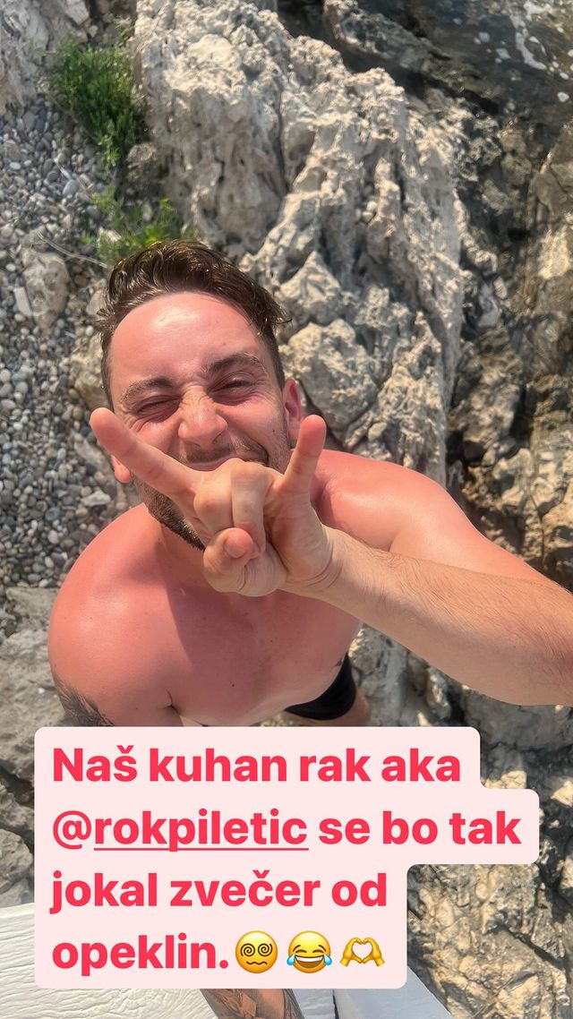 Roka Piletiča je močno opeklo sonce