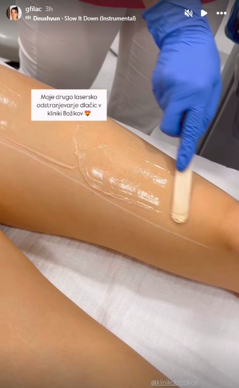 Gaja Filač je bila na laserskem odstranjevanju dlak. Vir: Instagram
