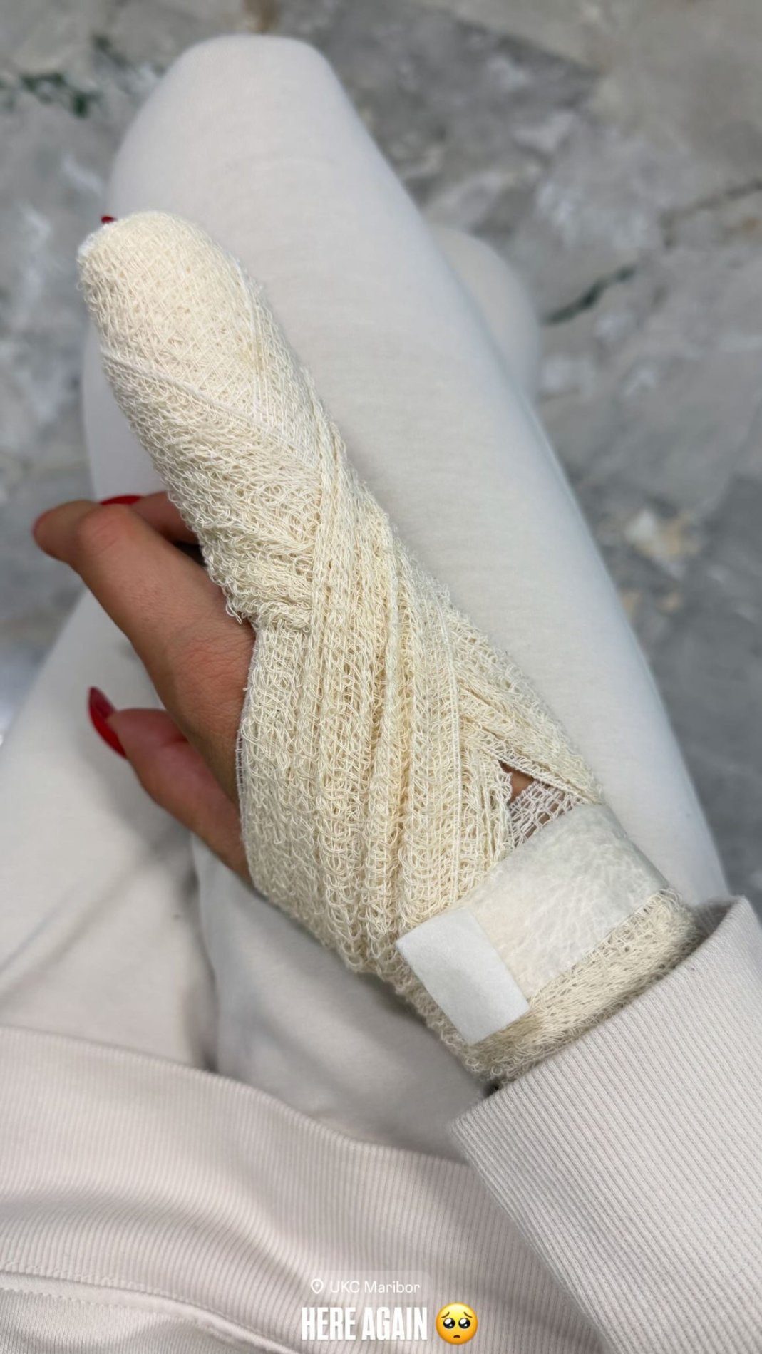 Carmen Osovnikar in njen prst. Vir: Instagram