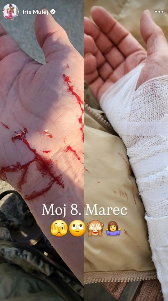 Iris Mulej je imela precejšnje rane