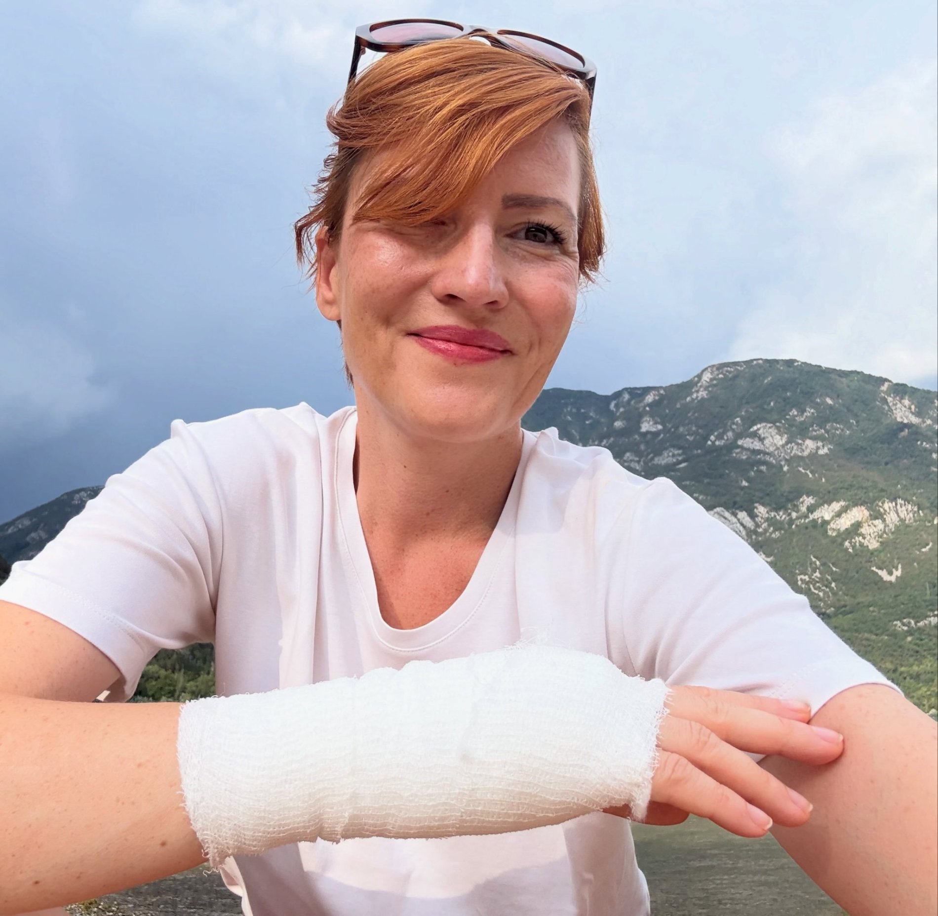 Poškodovana Asta Vrečko. Vir: Instagram